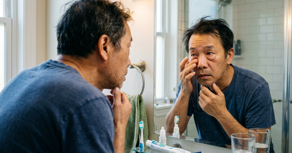 Kidney Health: Is Morning Eye Puffiness an Early Sign?